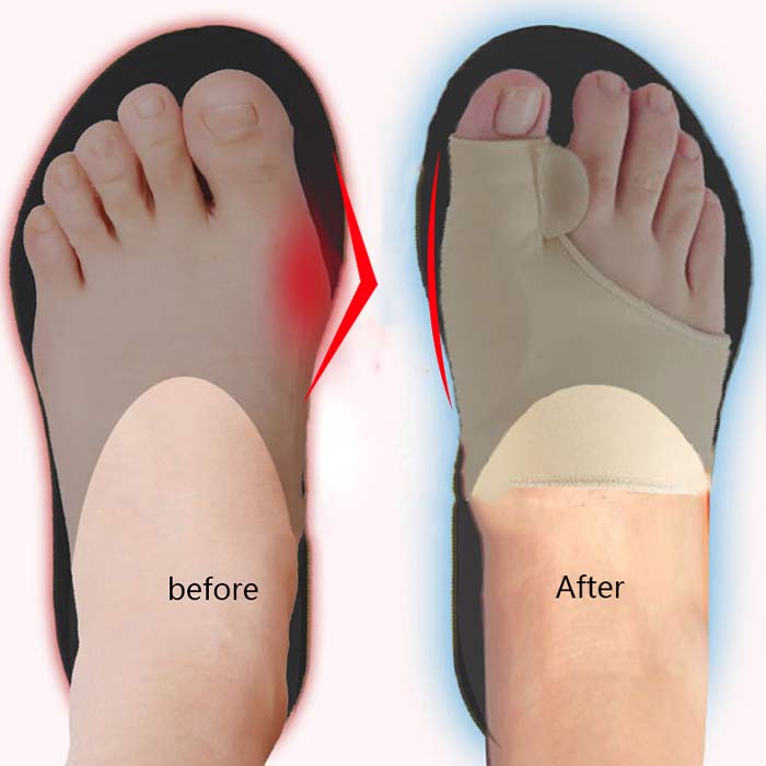 CorrectiveSocks, șosete corectoare - Image 3