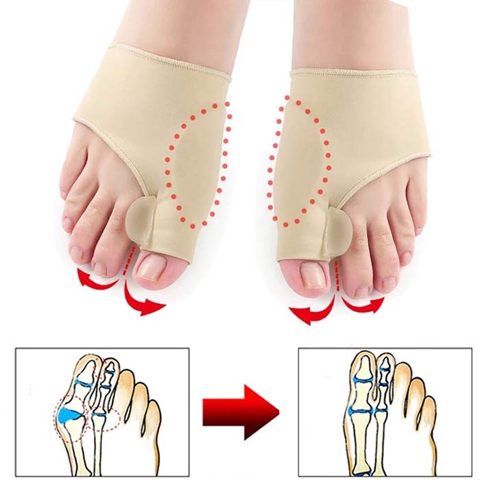 CorrectiveSocks, șosete corectoare - Image 5