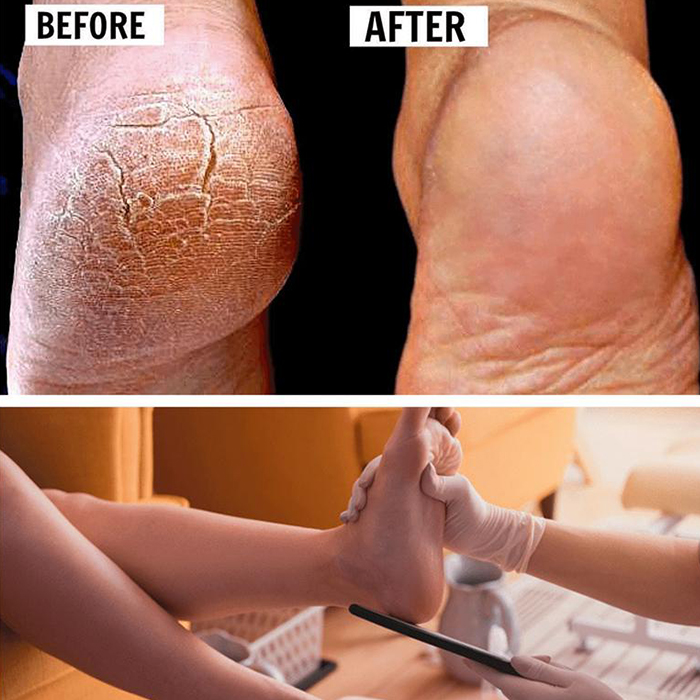 FootFile, pilă de mână pentru pedichiură - Image 7