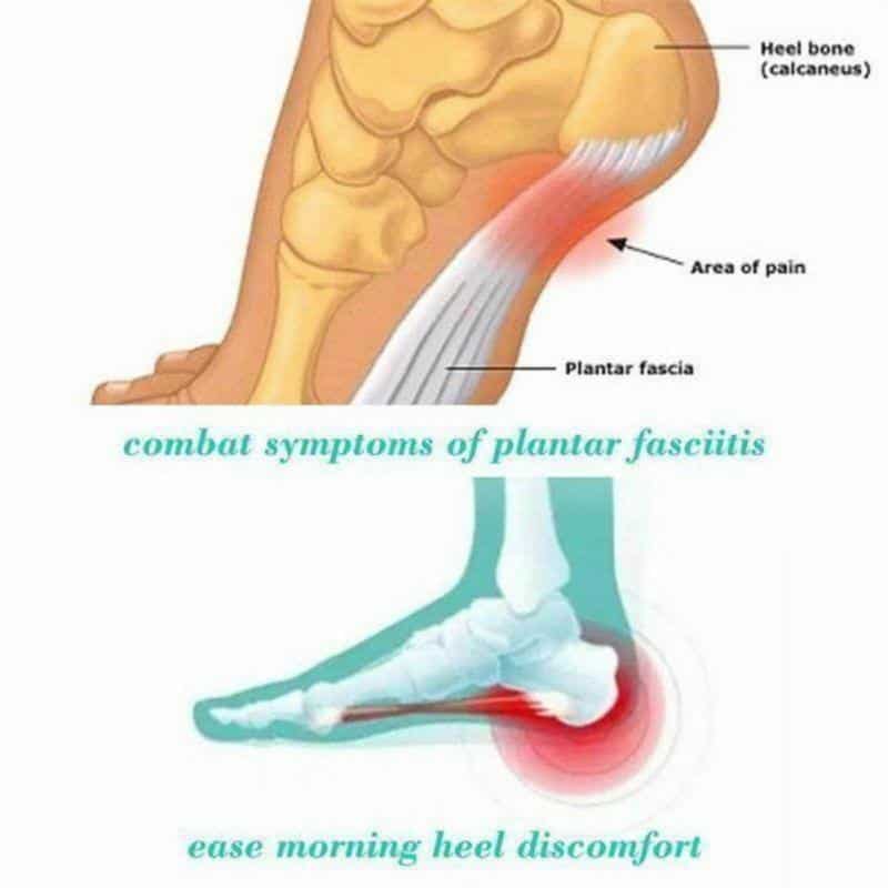 TherapySocks, șosete terapeutice cu magneți (1 pereche) - Image 3